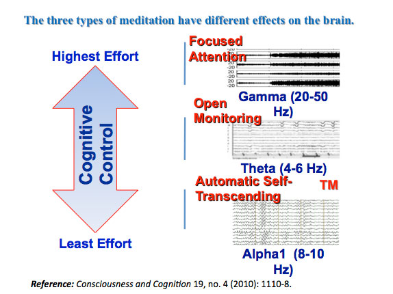 brainwave chart image